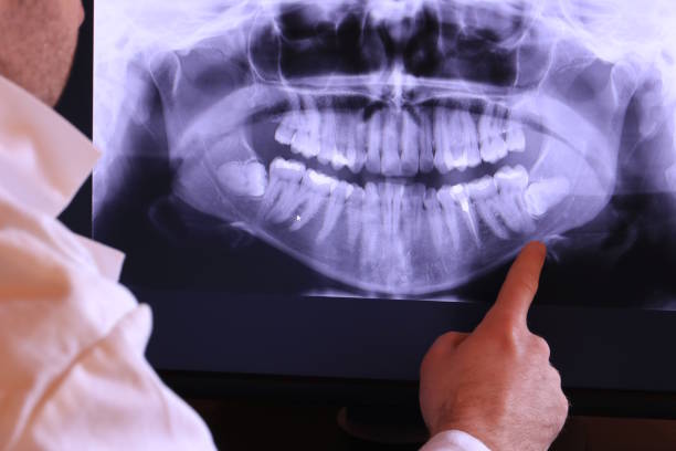 Best Emergency Dental Services for Seniors in Shenandoah Farms, VA
