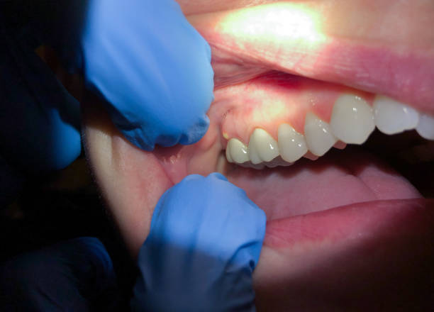  Shenandoah Farms, VA Emergency Dentist Pros