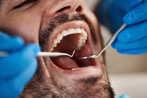 Best Emergency Dentist for Knocked-Out Tooth in Shenandoah Farms, VA