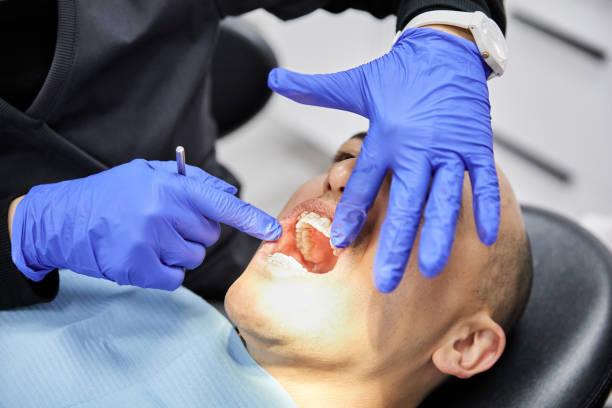 Best Emergency Dentist for Knocked-Out Tooth in Shenandoah Farms, VA